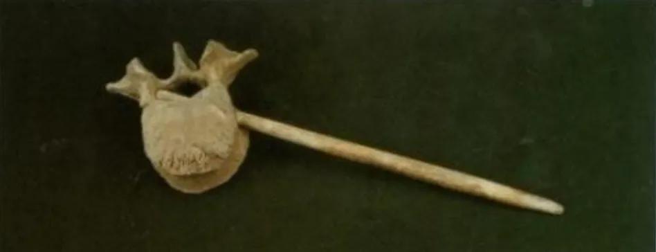 七千年前人们为何将“零口姑娘”残忍处死？