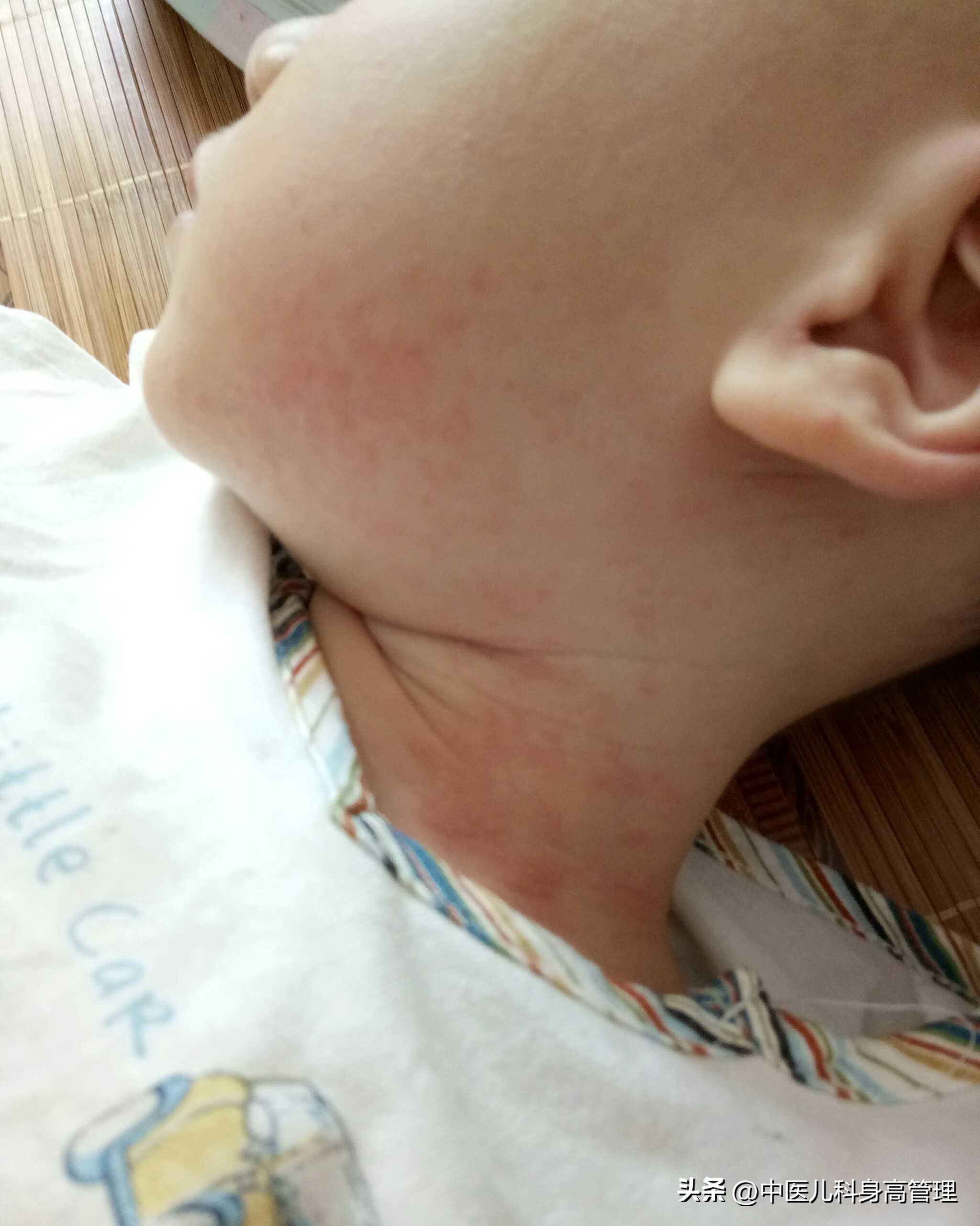 七周岁半女孩身高106是矮小症吗,中医可以治愈儿童矮小症吗