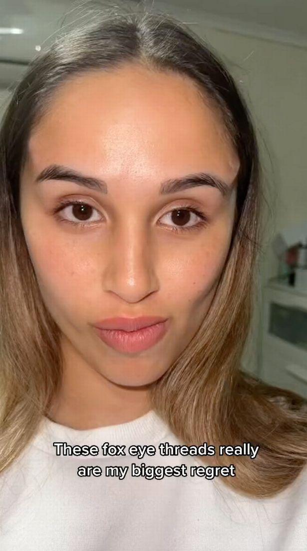 澳洲女做“狐狸眼”整容手术，结果看起来像“长着犄角的外星人”