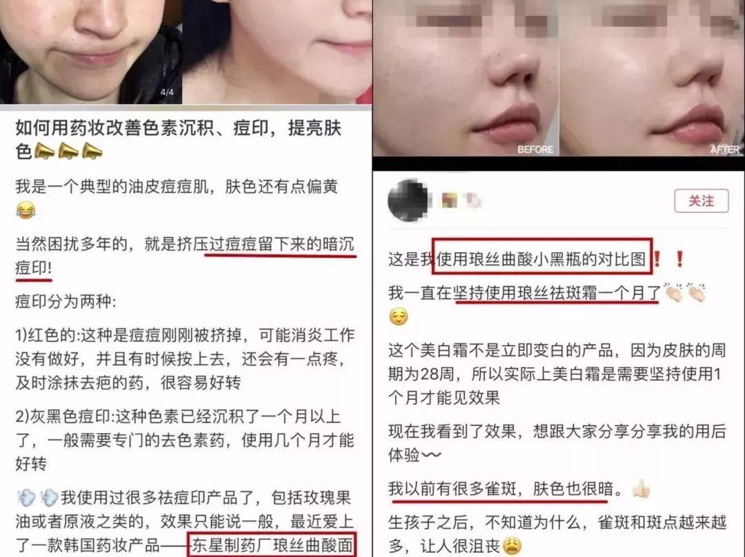 韩国东星小黑瓶祛斑霜，​韩国东星制药60年口碑企业出品！