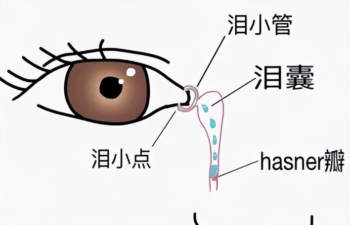 老年人泪道阻塞怎么按摩治疗视频,泪管堵塞中医手法治疗