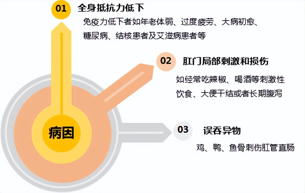 济南治疗肛周脓肿医院,济南中心医院肛周脓肿