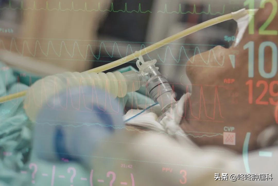 临床医生亲述：肝癌病灶破裂出血抢救纪实，敬畏生命！