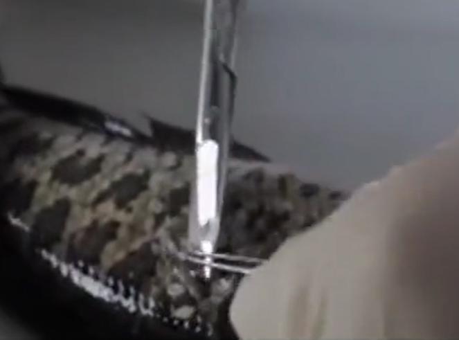 故事：湖北55岁男子病从口入，孕出成千上万虫卵，肚子竟成虫窝