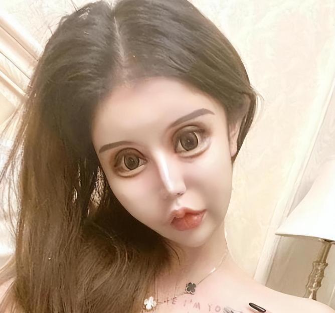 整容狂人整容100多次,整容狂魔手术200次