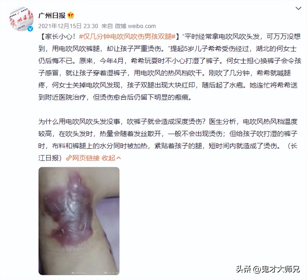 家长小心！仅几分钟吹伤5岁男娃，罪魁祸首竟是这样东西！