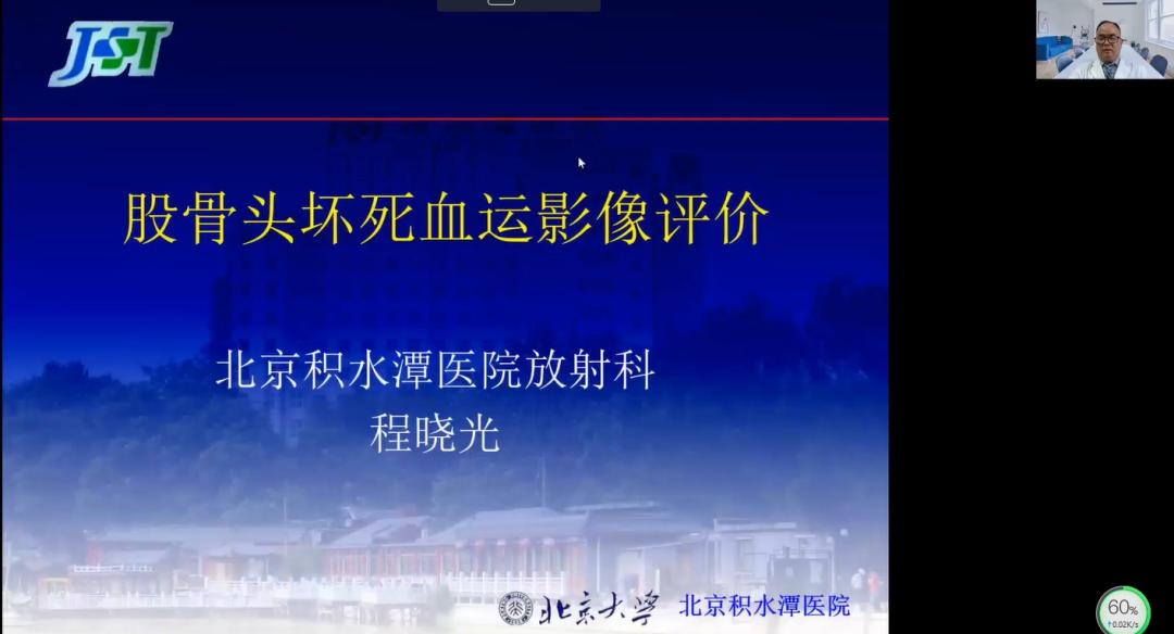 北京积水潭股骨头坏死二期专家,积水潭医院股骨头坏死宣传讲座