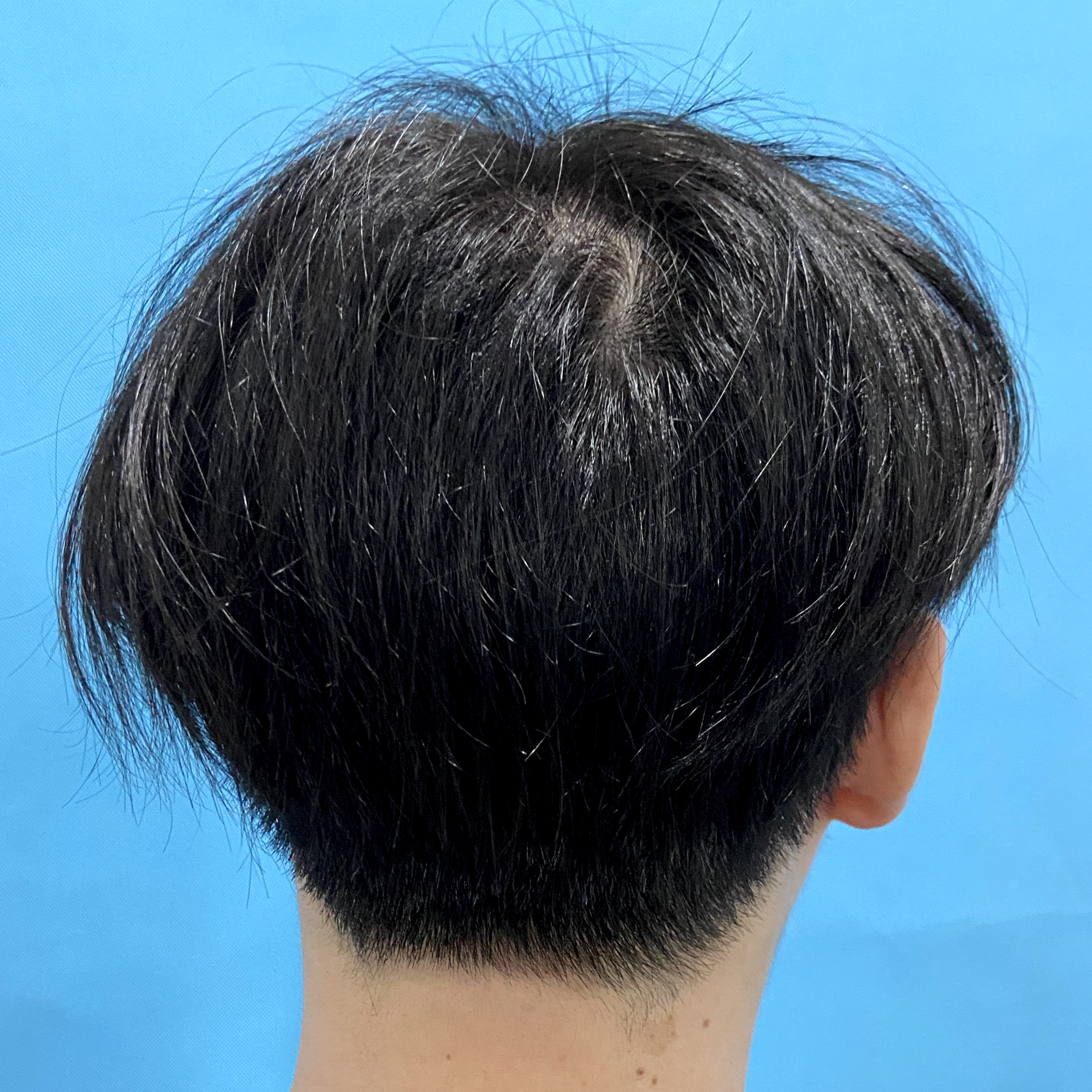 涓轰粈涔堟鍙戜簡杩樻槸鑴卞彂,妞嶅彂澶辫触璧斿灏戦挶