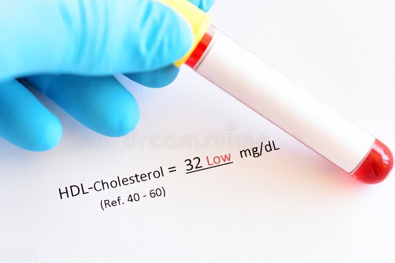 高脂血症和血脂高哪个严重,高脂血症严重吗需治疗吗