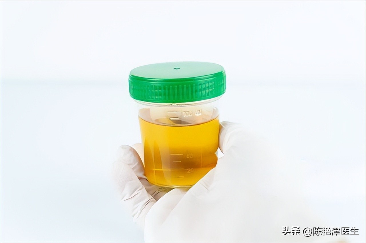 体检查出肾结石怎么办？医生：2个方法，或能让肾结石离开身体