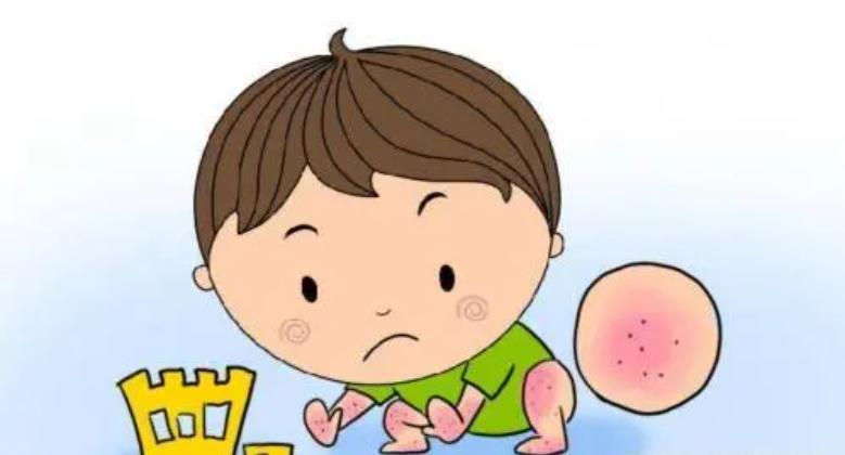 医学科普湿疹做好这几点减少复发,谈谈湿疹的中医药防治与调养