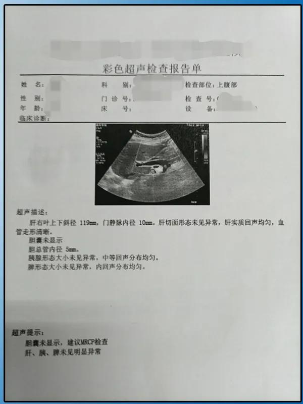 萎缩性胆囊炎胆囊结石严重吗,萎缩性胆囊炎是胆囊常见疾病吗