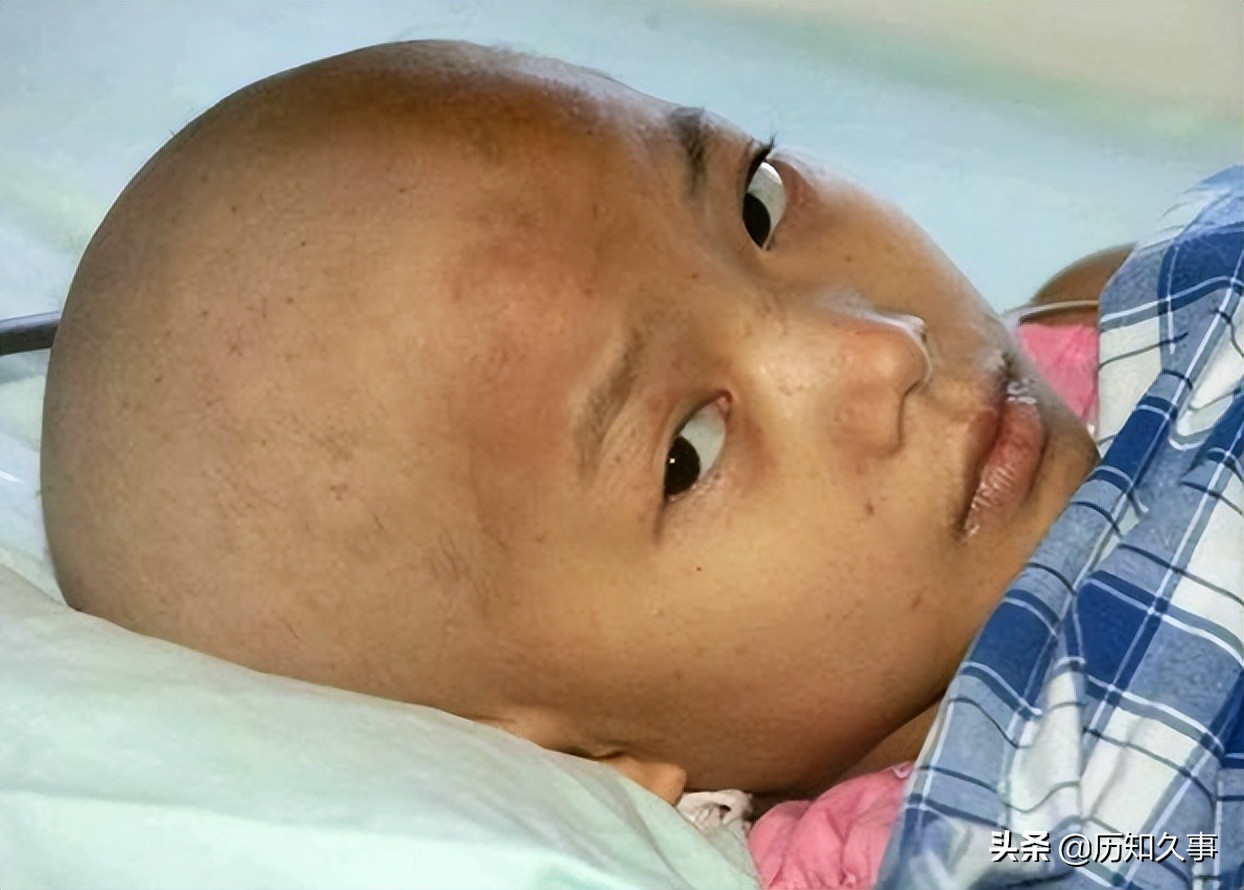 七岁女孩不幸得绝症后续,8岁白血病女孩为了养父写遗书