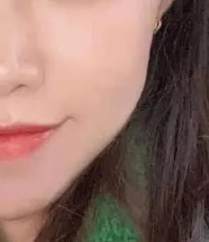 医院里的皮肤美容科靠谱吗,美容院做皮肤护理毁容怎么办