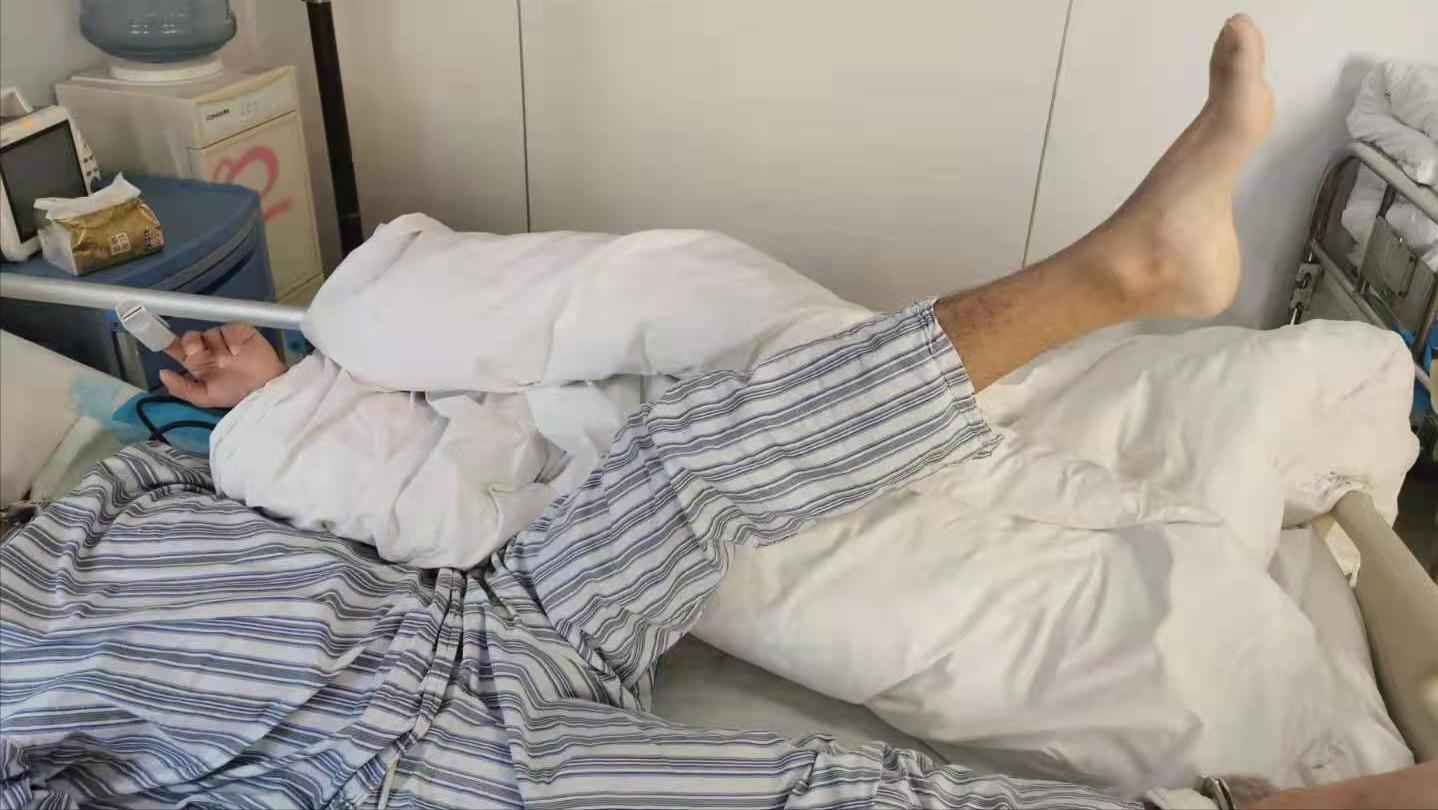 老年人弯腰驼背怎么治,老人弯腰驼背怎么回事