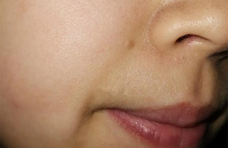 男人脸黑红是怎么回事,脸又黑又肿是什么原因