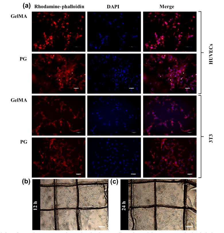 「科研快报」PCL纤维/GelMA水凝胶敷料用于糖尿病伤抗菌和愈合