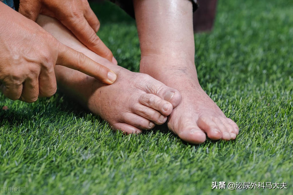 尿血就一定是癌症前兆吗？医生：不谈血色变，也不掉以轻心