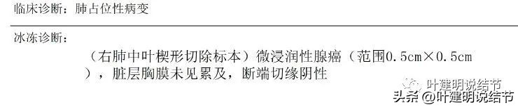 肺癌右中上叶全切,右肺上叶小结节查出是癌怎么办