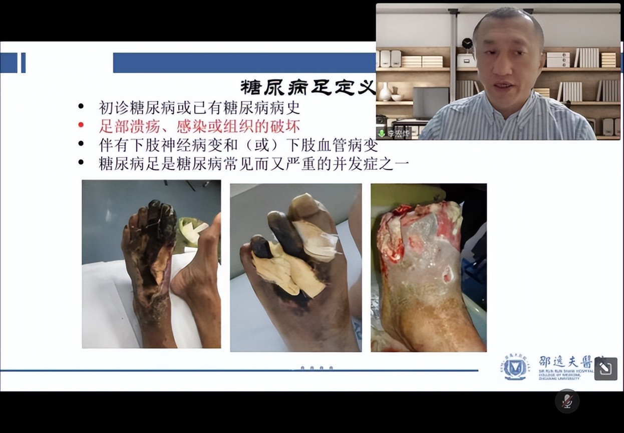 2022年足踝外科康复医学会议,创面修复学术研讨会