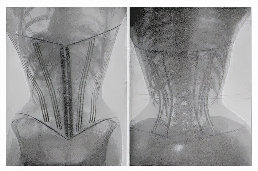 无数中国女性被骗,这种瞄准女性子宫的智商税,不要再信了