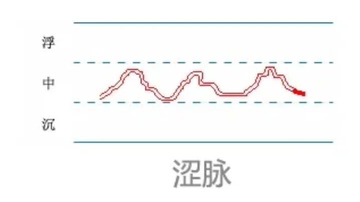 中医28脉诊歌诀及示意图,中医28脉全部脉象图解