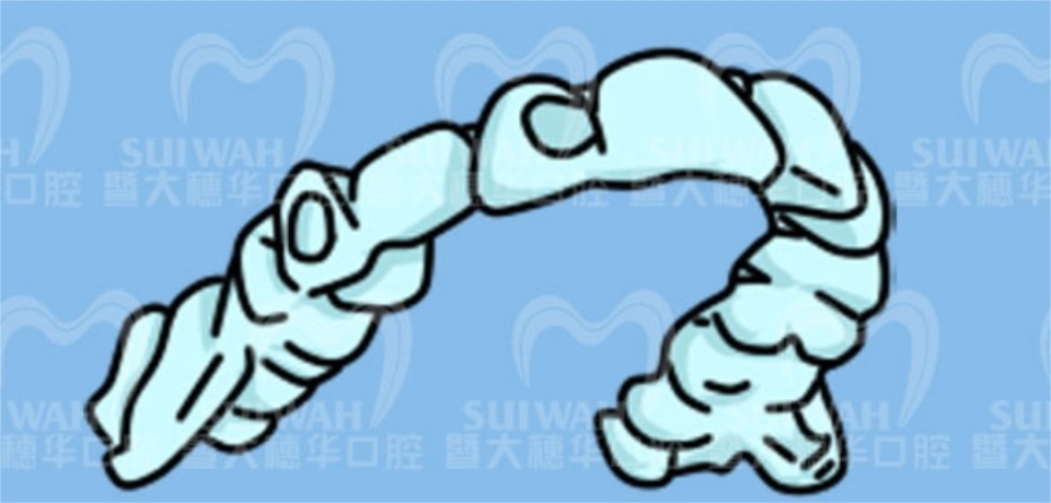 牙齿缝隙越来越大是怎么回事,45岁牙齿缝隙越来越大能矫正吗