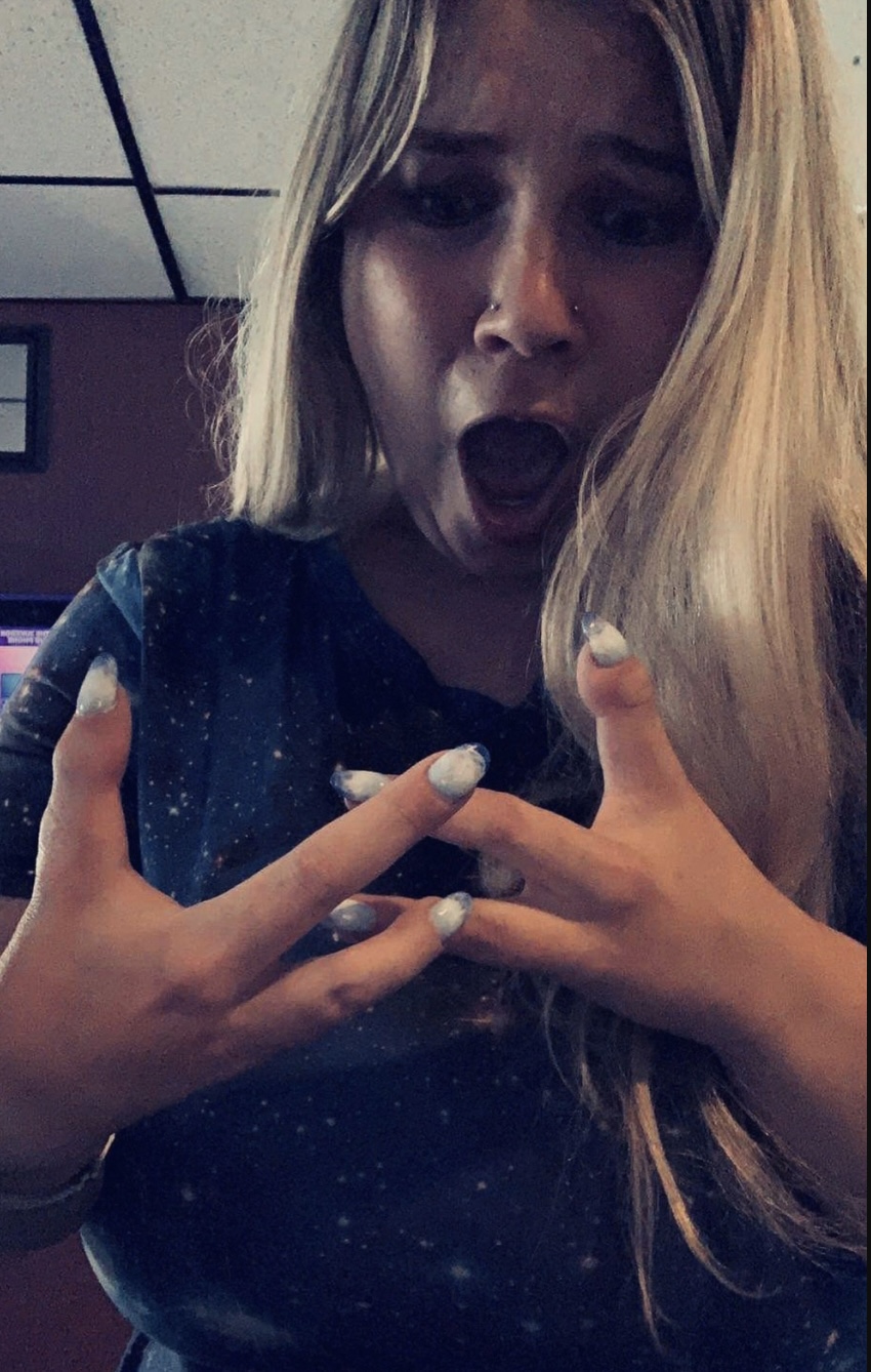 妹子天生只有3根手指，别人说她“霸王龙”，她用乐观狠狠反击！