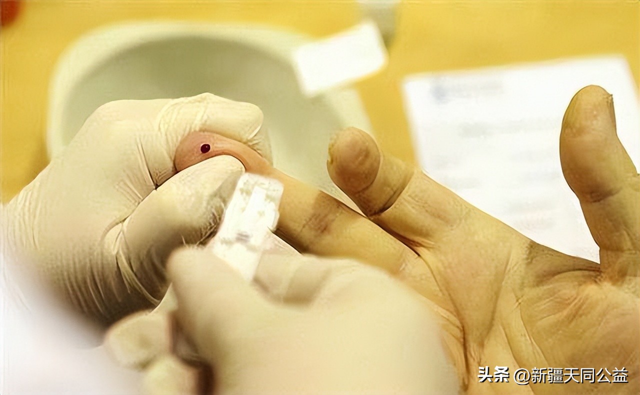 持续低烧查出艾滋病,男子发热20天被确诊艾滋病