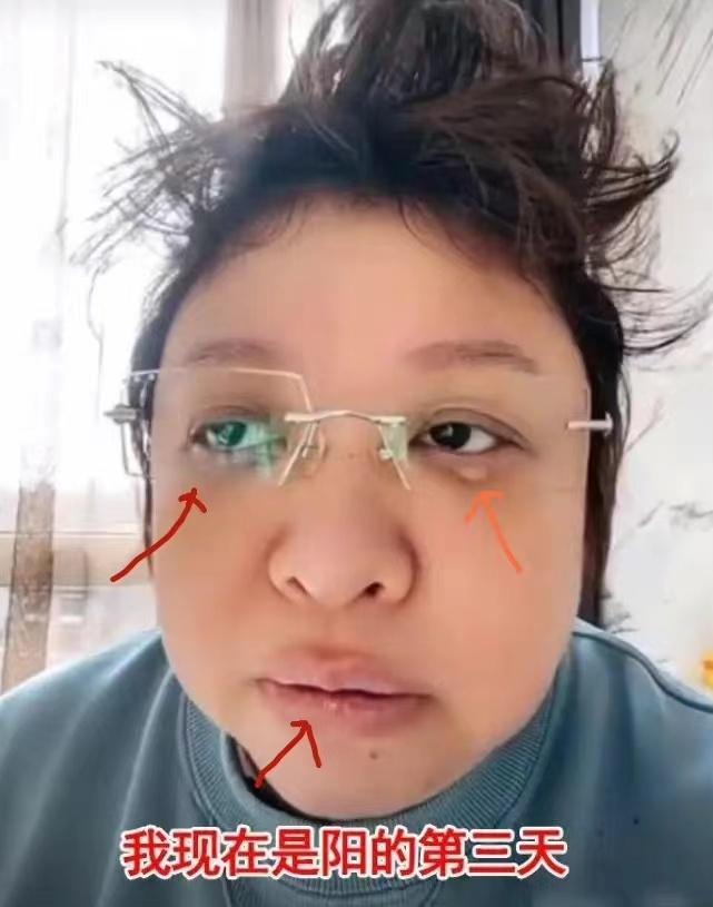 确诊阳性的明星,被确诊为阳性的明星