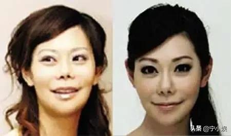 整容达人200次整容失败整成僵尸,整容成功逆袭案例削骨