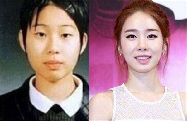 有关整容的韩剧女明星,韩剧女主整容前后对比