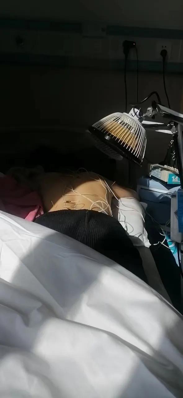 后背拔罐疼痛怎么缓解,拔罐能缓解后背疼痛吗