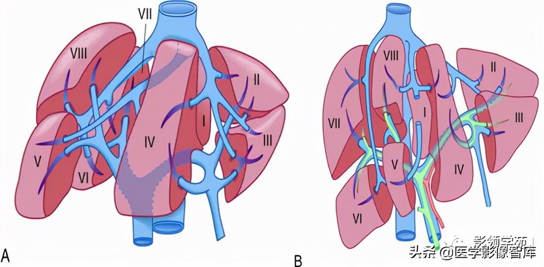 肝脏影像分叶分段解剖图,肝脏分段解剖图谱