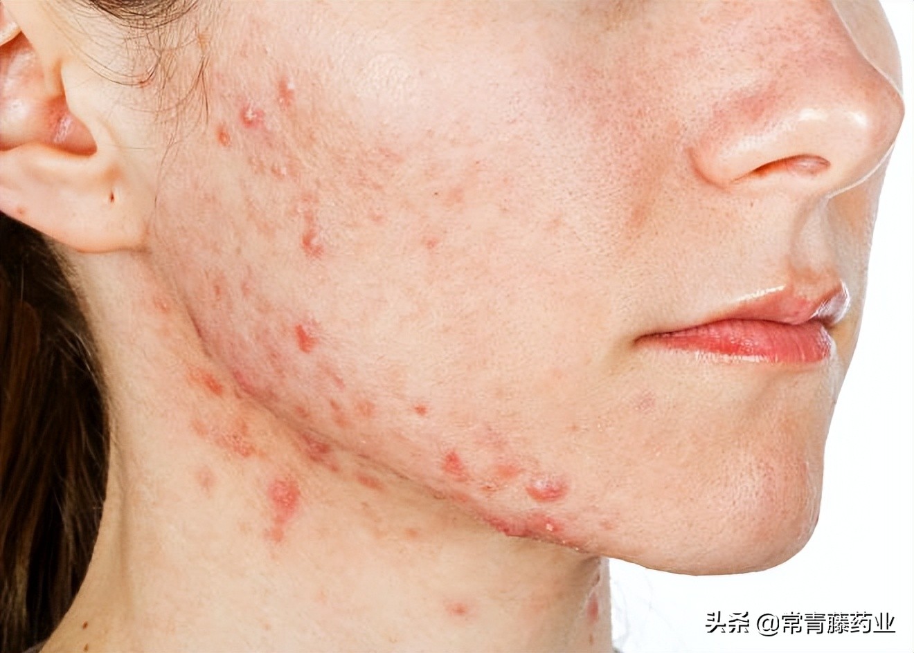 脸颊肿了一个包硬硬的怎么处理,脸颊长个包硬硬的凸起