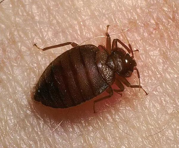 虫咬性皮炎的防治方法有哪些,去除顽固性虫咬皮炎的简单方法