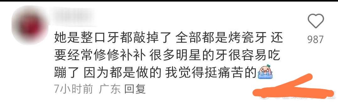 刘涛的烤瓷牙取下后的模样,刘涛满嘴烤瓷牙吗