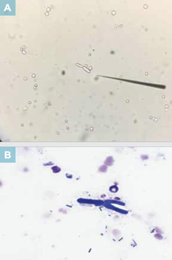 尿液干化学分析的实验原理,尿液标本采集操作
