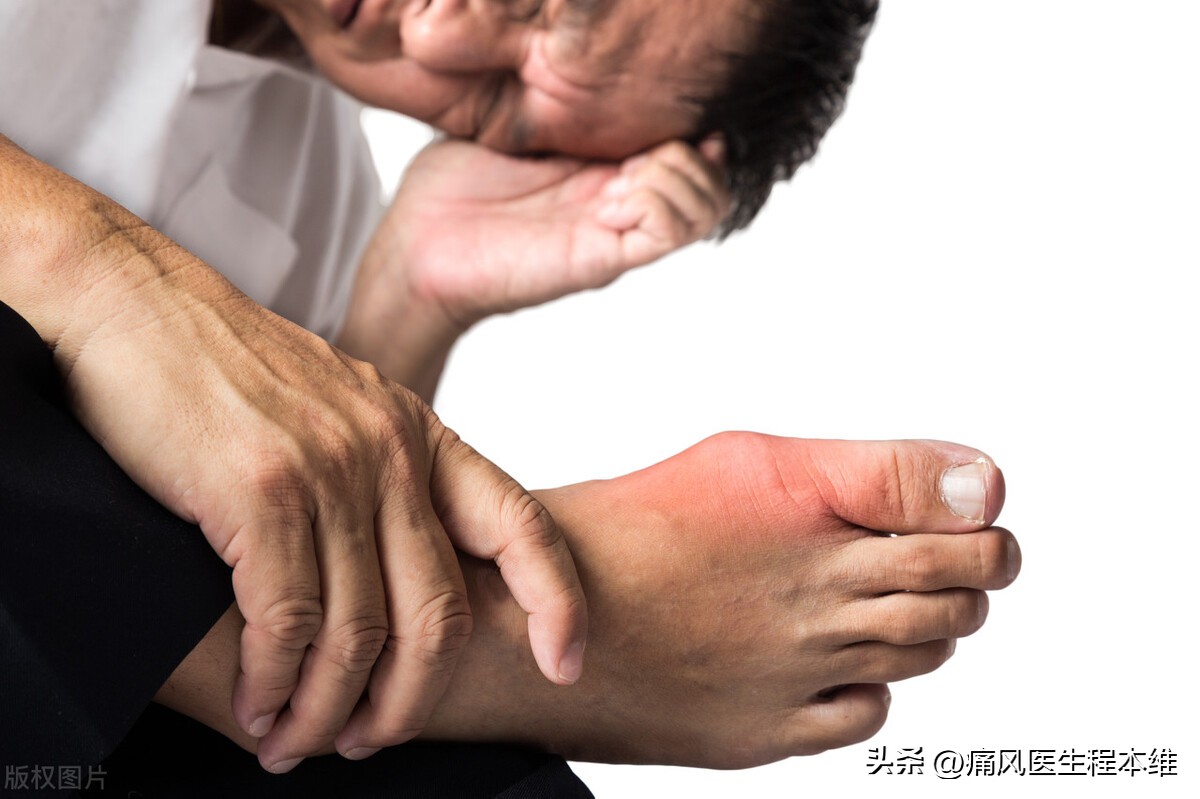 痛风吃降尿酸药还可以吃发烧药吗,痛风药能和降压药一块吃吗