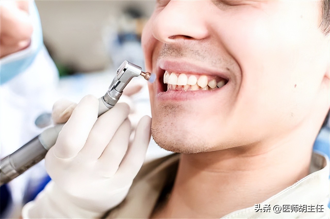 清理牙缝牙结石最有效方法,如何清除牙缝里的牙结石