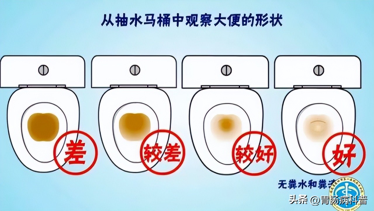 做肠镜检查前怎样清肠最彻底,肠镜检查前清肠的药怎么喝