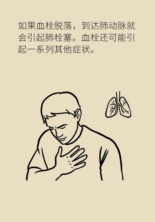 长途飞行腿部浮肿怎么办,长途旅行脚肿怎么办