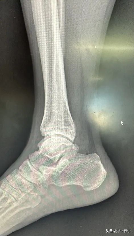 西宁市第三人民医院外科,西宁第三人民医院扩建项目