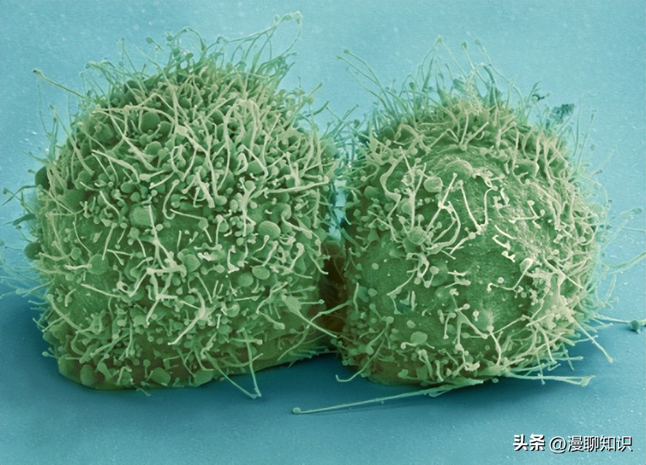 妇阴康洗剂的用途,妇阴康洗剂是抗生素药吗