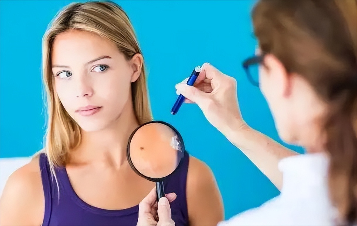 医生如何检查黑痣和黑色素瘤,医生长在摩擦部位的黑痣要当心