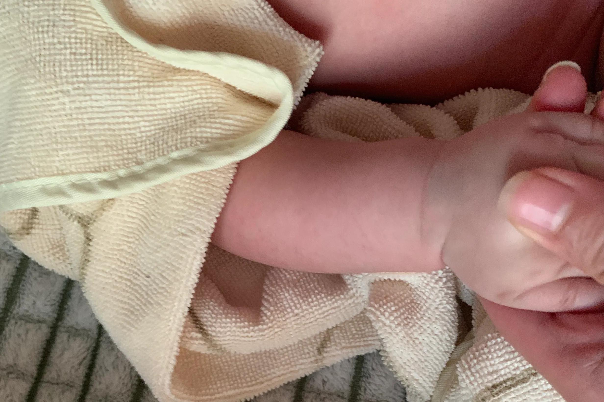 我家宝宝手上有胎记,宝宝身上有个胎记模糊不清