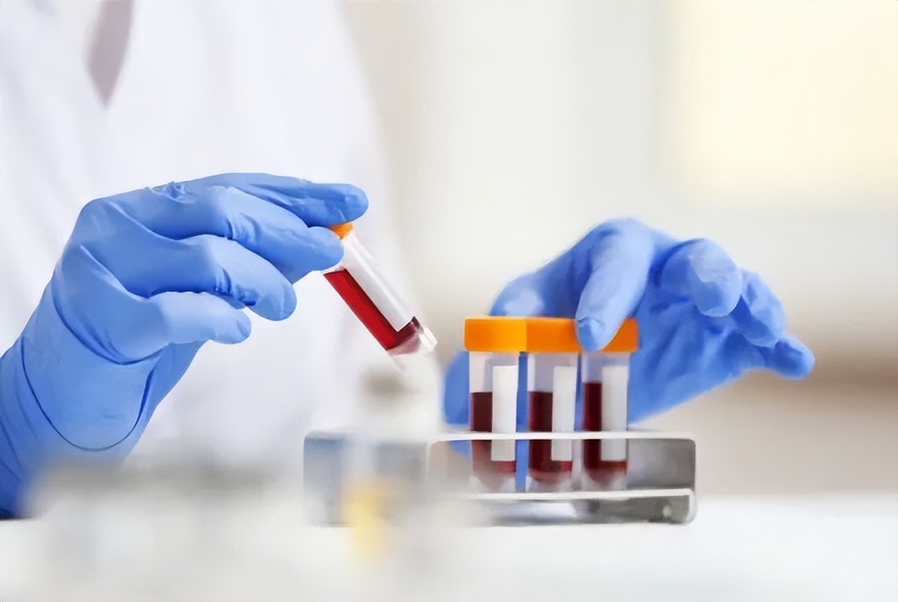 幽门螺杆菌检测c13和c14的区别,正确解读幽门螺杆菌检验结果