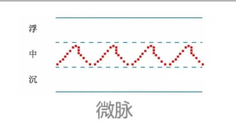 中医28脉诊歌诀及示意图,中医28脉全部脉象图解