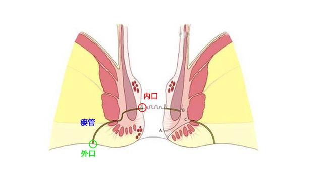 十大最痛苦的手术是什么,十种最痛的手术