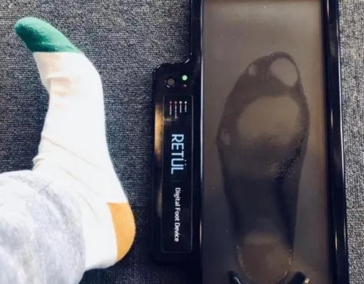 脚气真菌怎么治才能除根,脚气真菌怎么彻底消灭